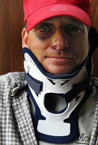 Seemingly random attack baffles St. Louis victim