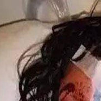 Woman Blinded In One Eye After Officer Shot Bean Bag At Car In