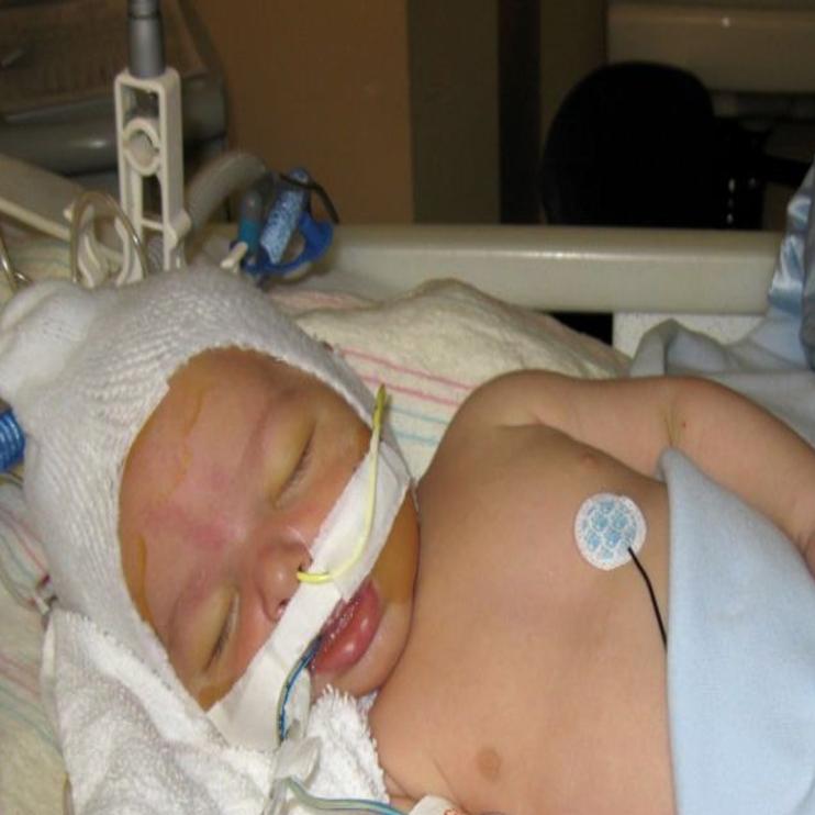 Mothers Of Injured Babies Join Cdc S New Education Effort About
