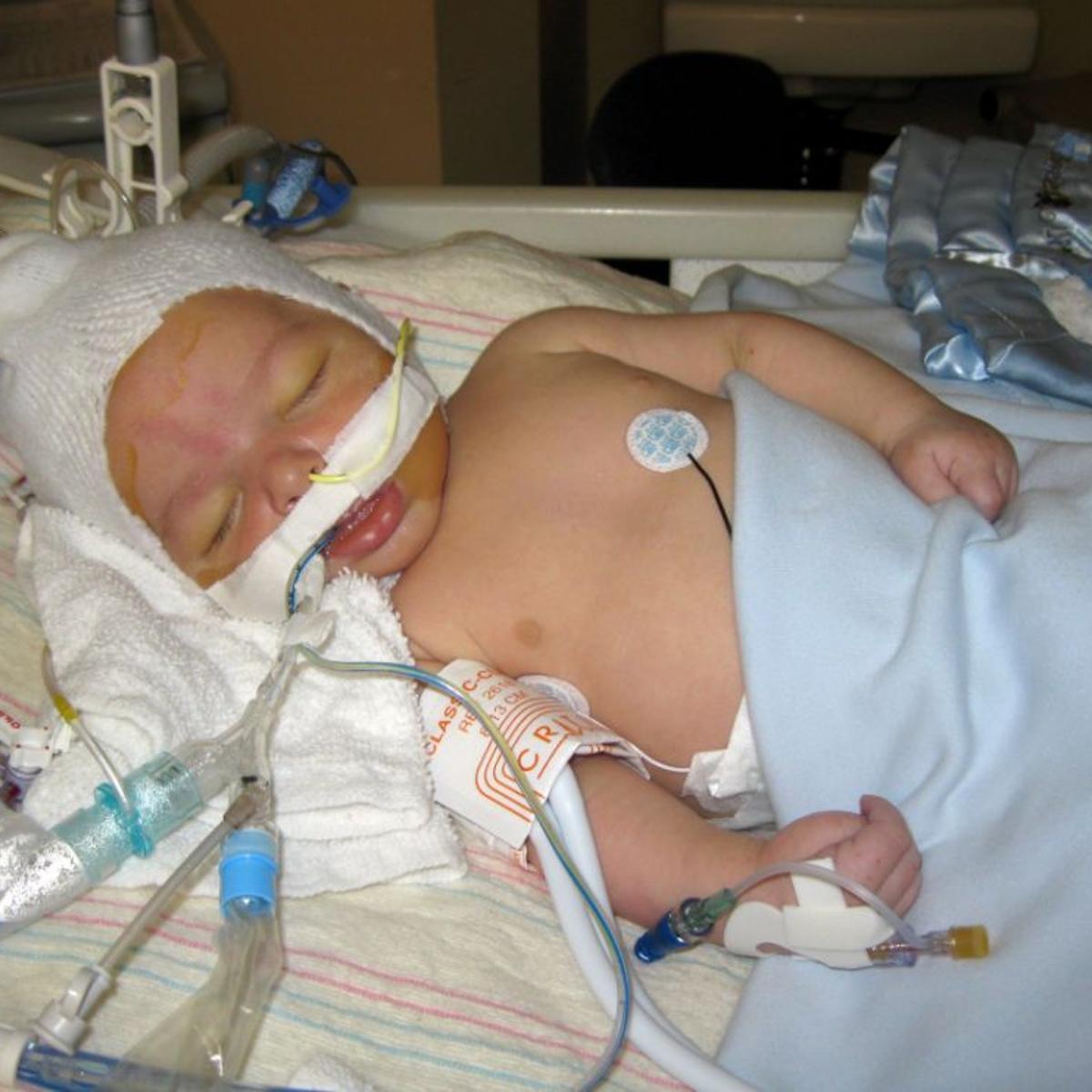 Mothers Of Injured Babies Join Cdc S New Education Effort About