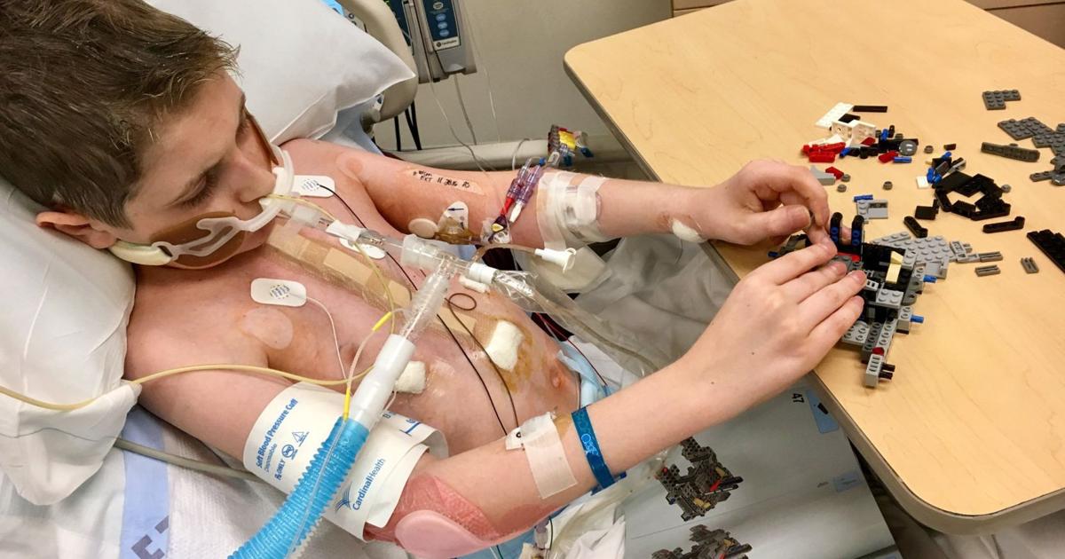 Lung Transplant Incision