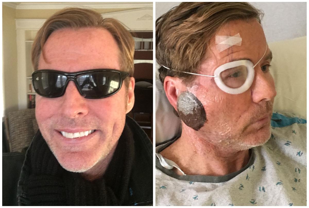 Media Views Exsportscaster McKenna battles major health issues