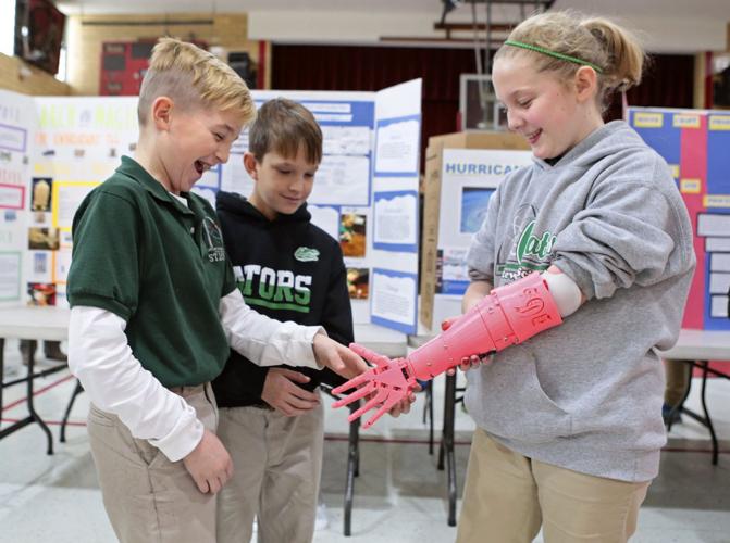 Kids test lower cost and lighter weight prostheses made by 3D printers in new study at Children's Hospital