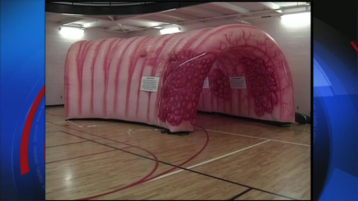 10footlong inflatable human colon stolen in Kansas City(01)