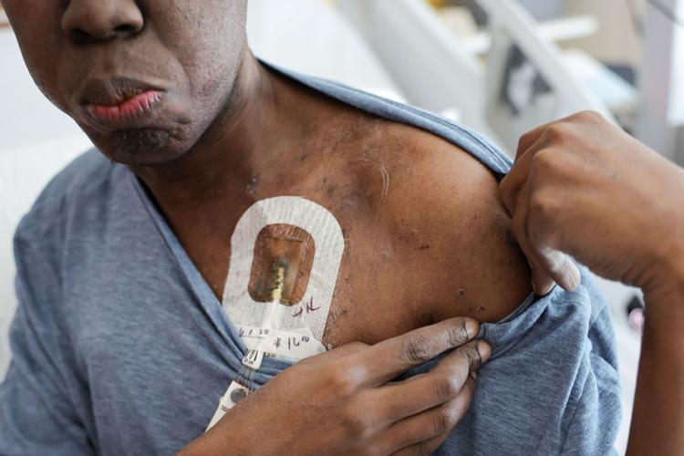 Man receives gene therapy for sickle cell disease