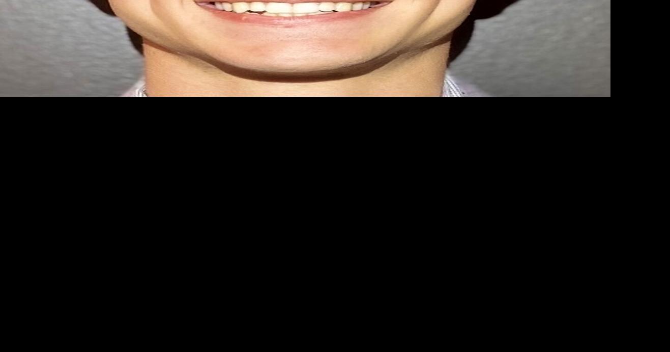 Parkway Central Andrew Ahrens