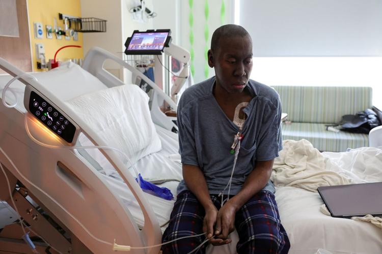 Man receives gene therapy for sickle cell disease