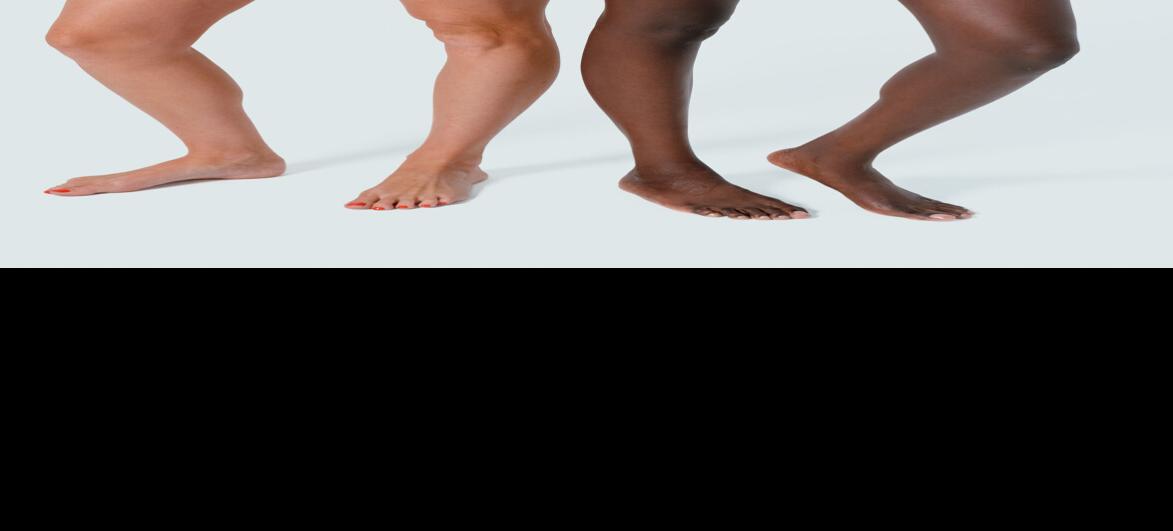 Milan Laser Hair removal