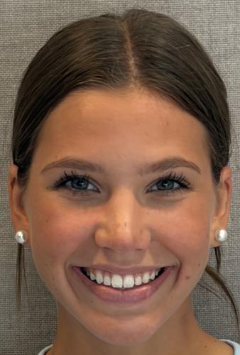 Emily Perone, Summit softball