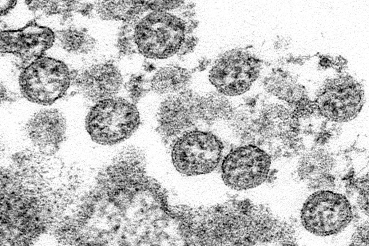 Virus Review Clusters Erupt At Universities Nationwide As Semester Begins Here S The Latest Nation Stltoday Com
