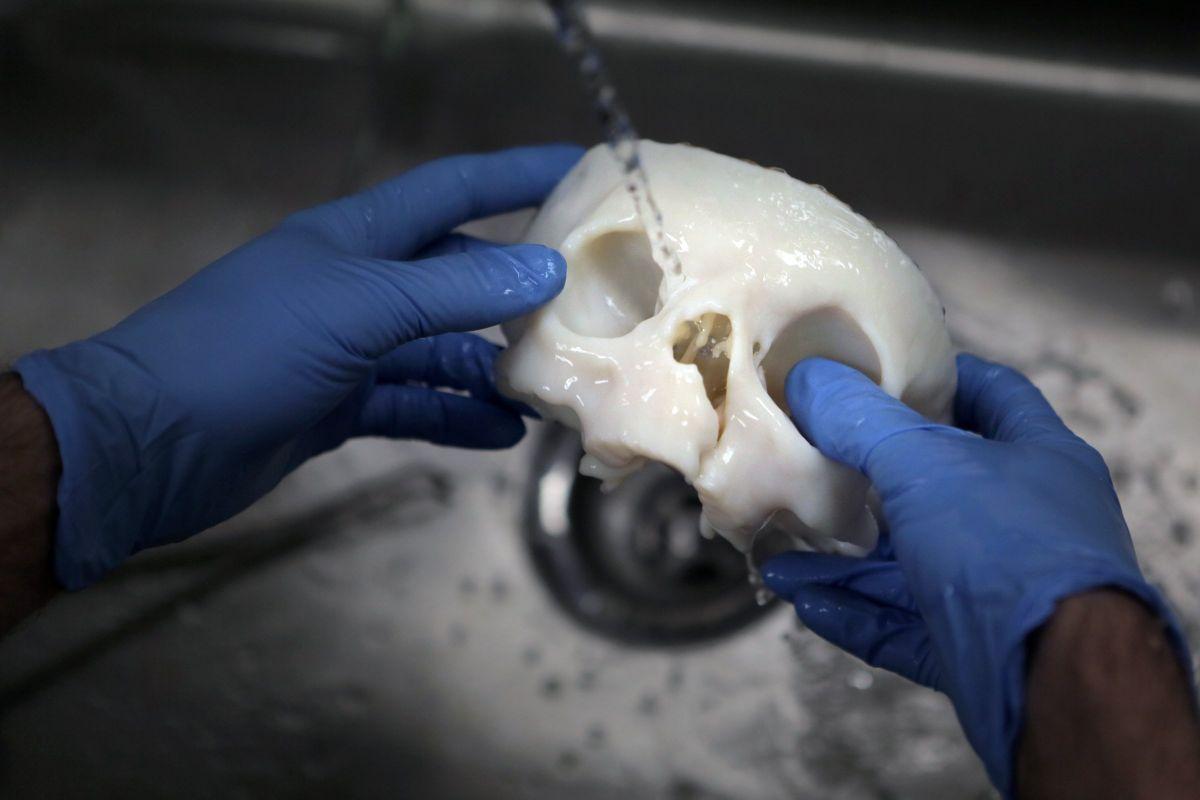 3 D Printing Comes To The Hospital Health Stltoday Com