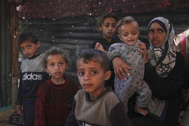 Mideast Wars Malnourished Children