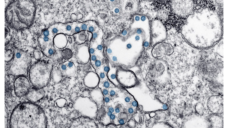 coronavirus
