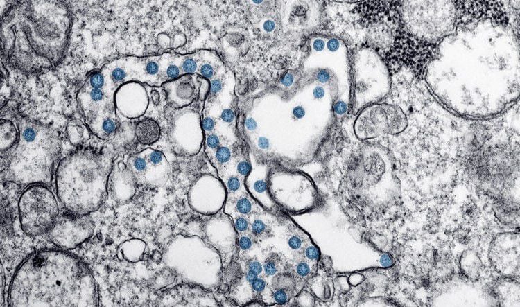 coronavirus