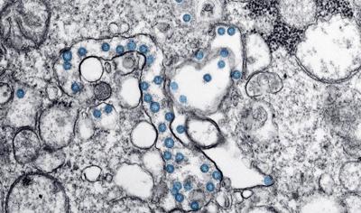 coronavirus
