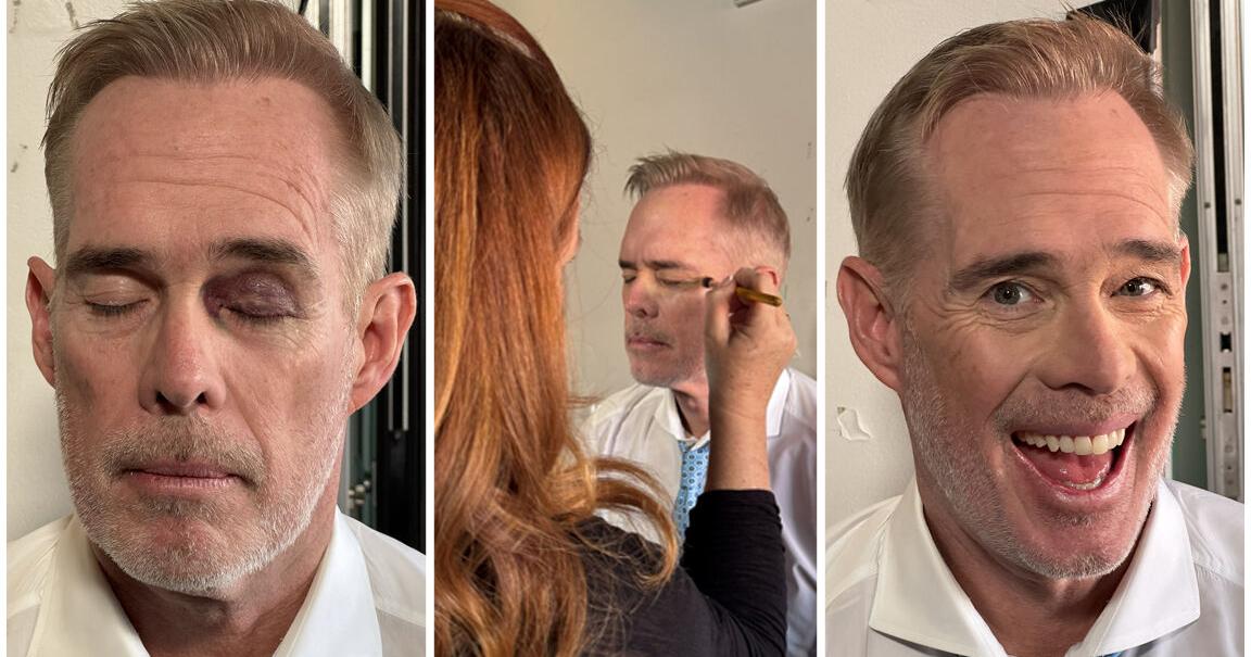 ESPN makeup artist able to hide Joe Buck's black eye on NFL telecast: Media Views