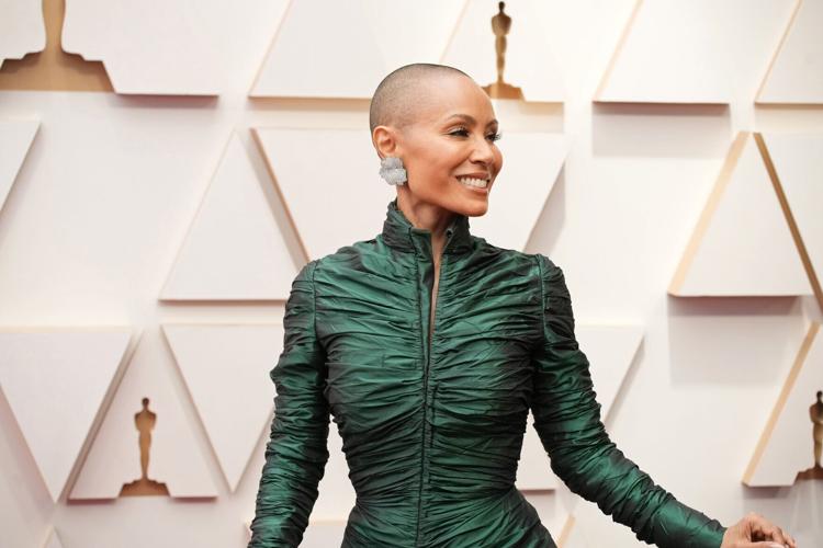 Oscars controversy shines a light on Jada Pinkett Smith's 'struggle' with alopecia