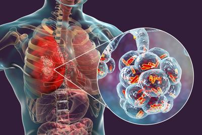 Pritzker Hageman Legionnaires' Disease Lawyers Investigate Central Harlem Legionnaires' Outbreak
