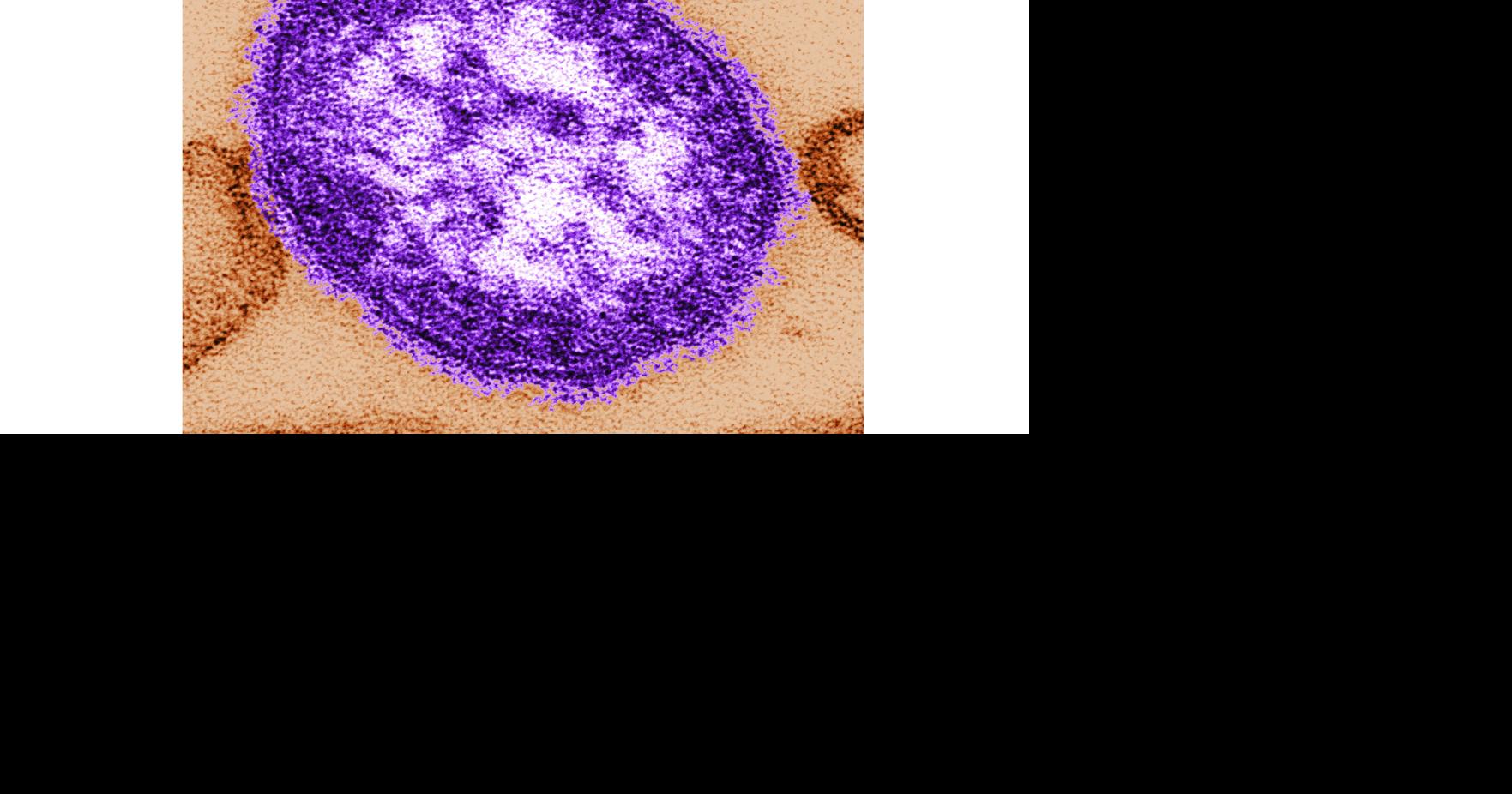 Coroner releases details of infants who died amid growing Pennsylvania measles outbreak A Pennsylvania coroner confirms that the two measles-related deaths in Pennsylvania last month involved infants, and the virus itself caused one of the deaths By MIKE STOBBE - AP Medical Writer Sep 9, 2026 15 mins ago