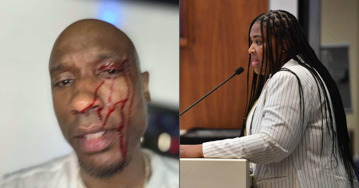 Lawsuit: Former Baton Rouge mayor's staffer hit activist with a chair, video captured assault