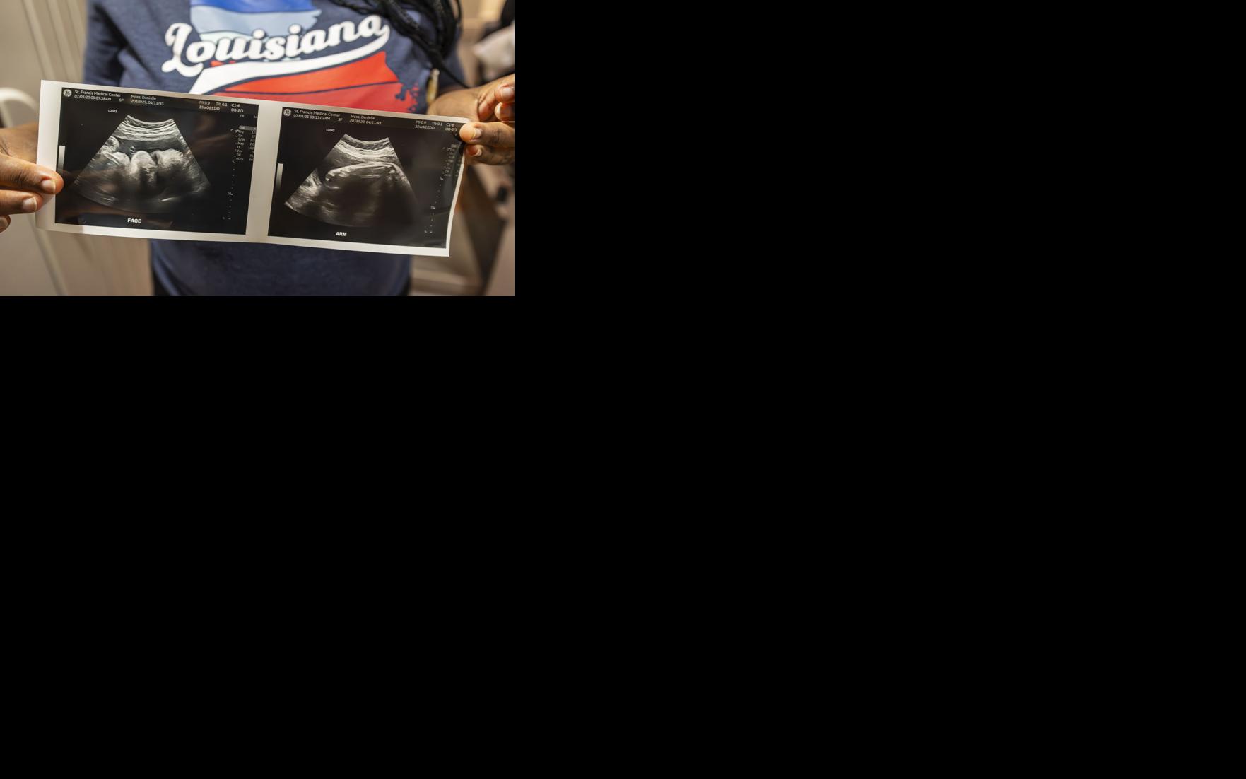 Asset-image