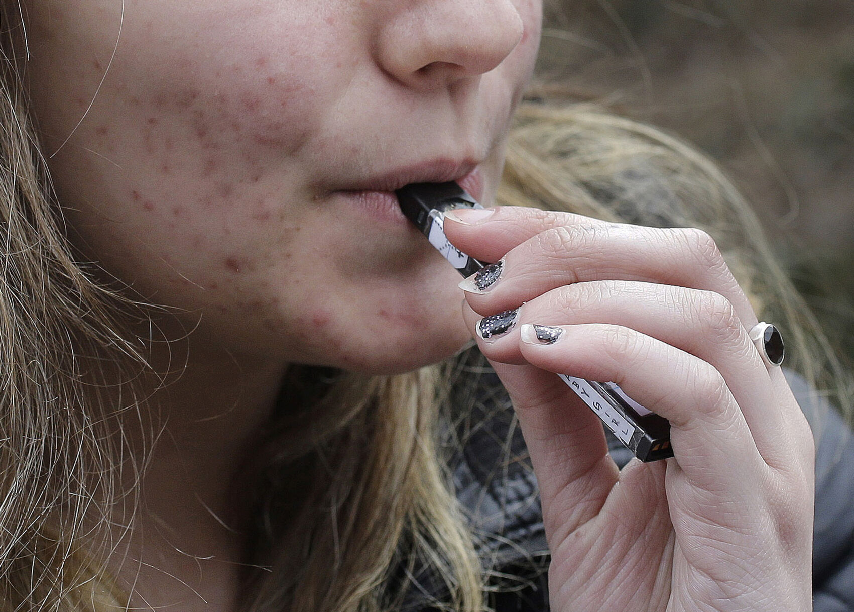 Teen vaping still dangerous despite recent decline say health