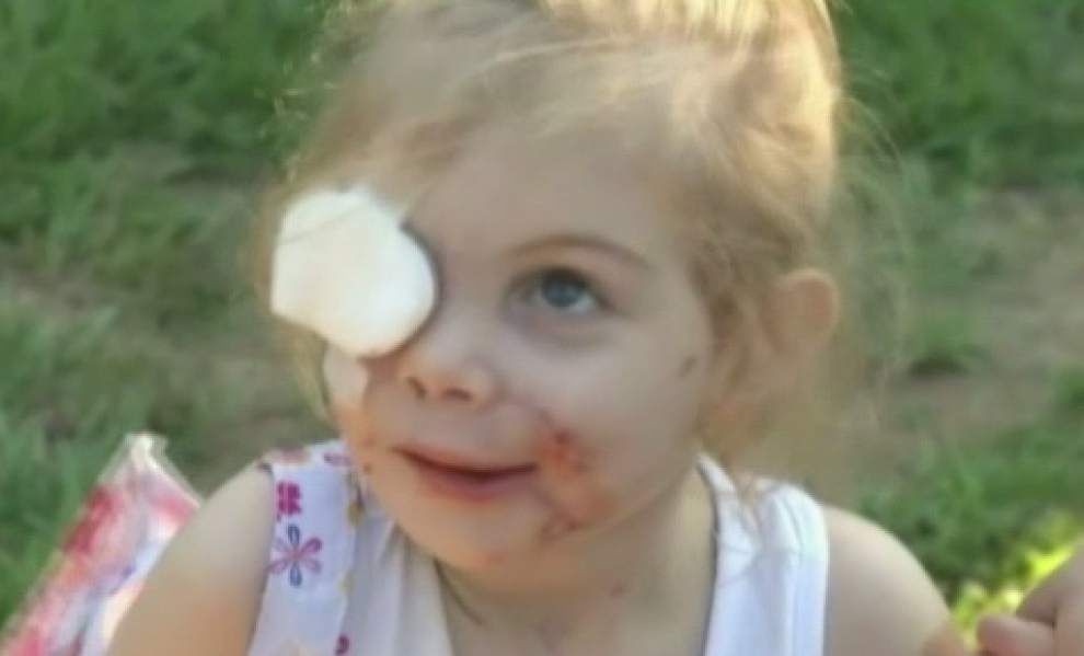 Grandma: Child booted from KFC over facial scars _lowres