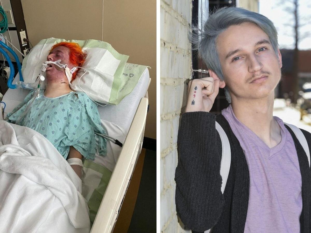 Holden White, a gay man, was brutally attacked by Chance Seneca 