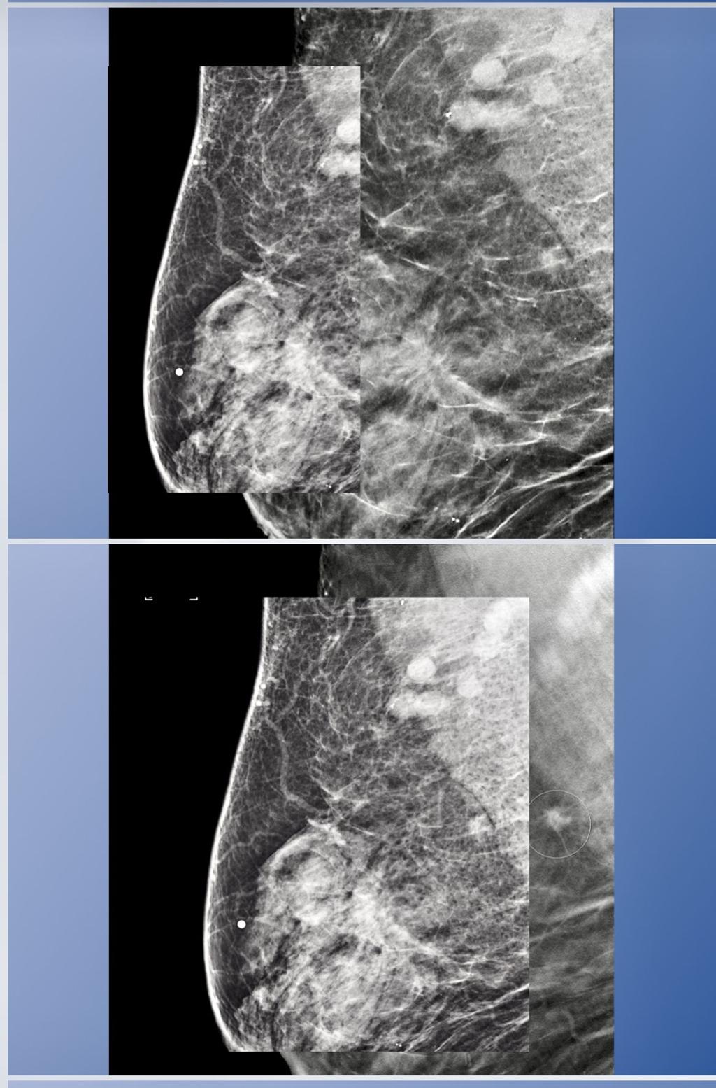 Woman S Hospital And Mary Bird Perkins Cancer Center Taking Part