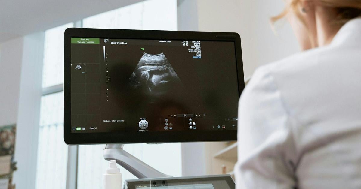 Additional premium increases possible for state health plan