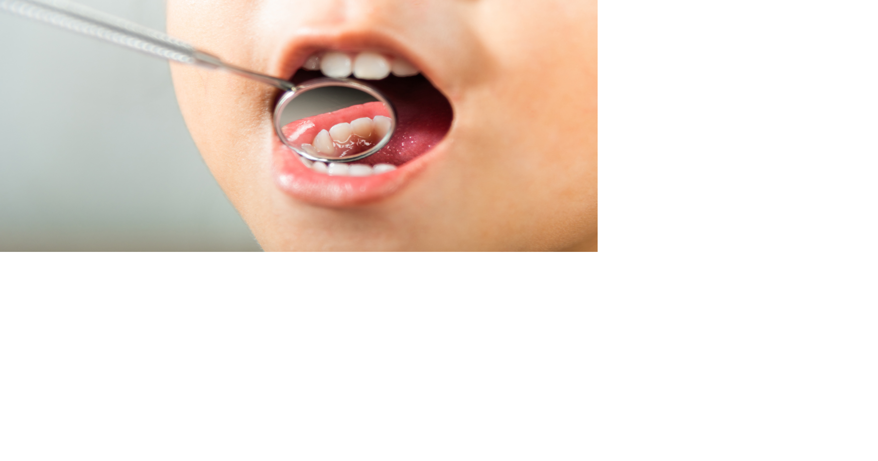 Healthy Habits Promote Strong, Healthy Teeth: Tooth decay is preventable | Health