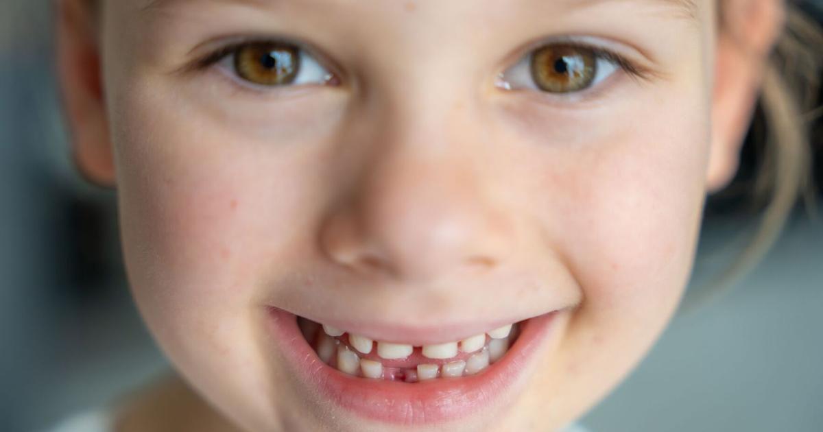 Tiny Teeth, Big Futures: The importance of early oral care | Health Tiny Teeth, Big Futures: The importance of early oral care | Health