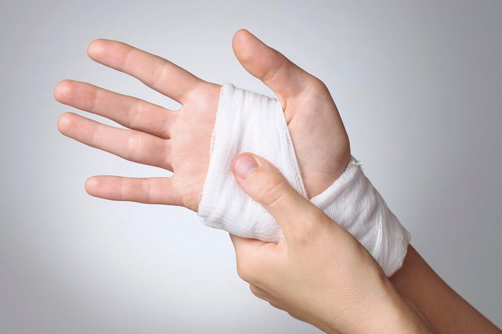 What should you do if you burn yourself? Health