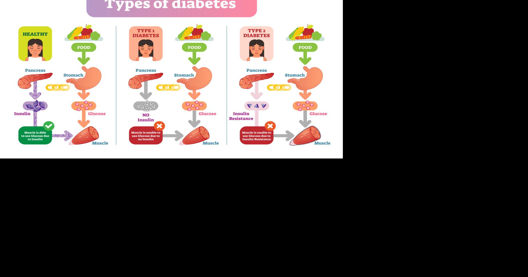 How to fill your plate if you have diabetes | Health | themountaineer.com
