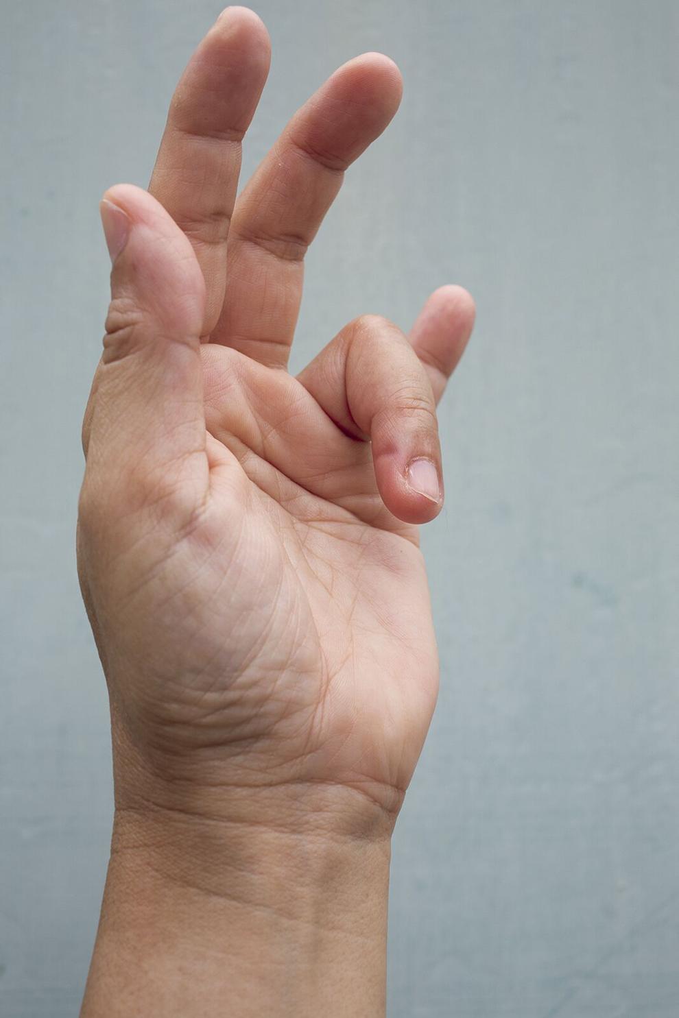 Trigger finger causes and treatments Health