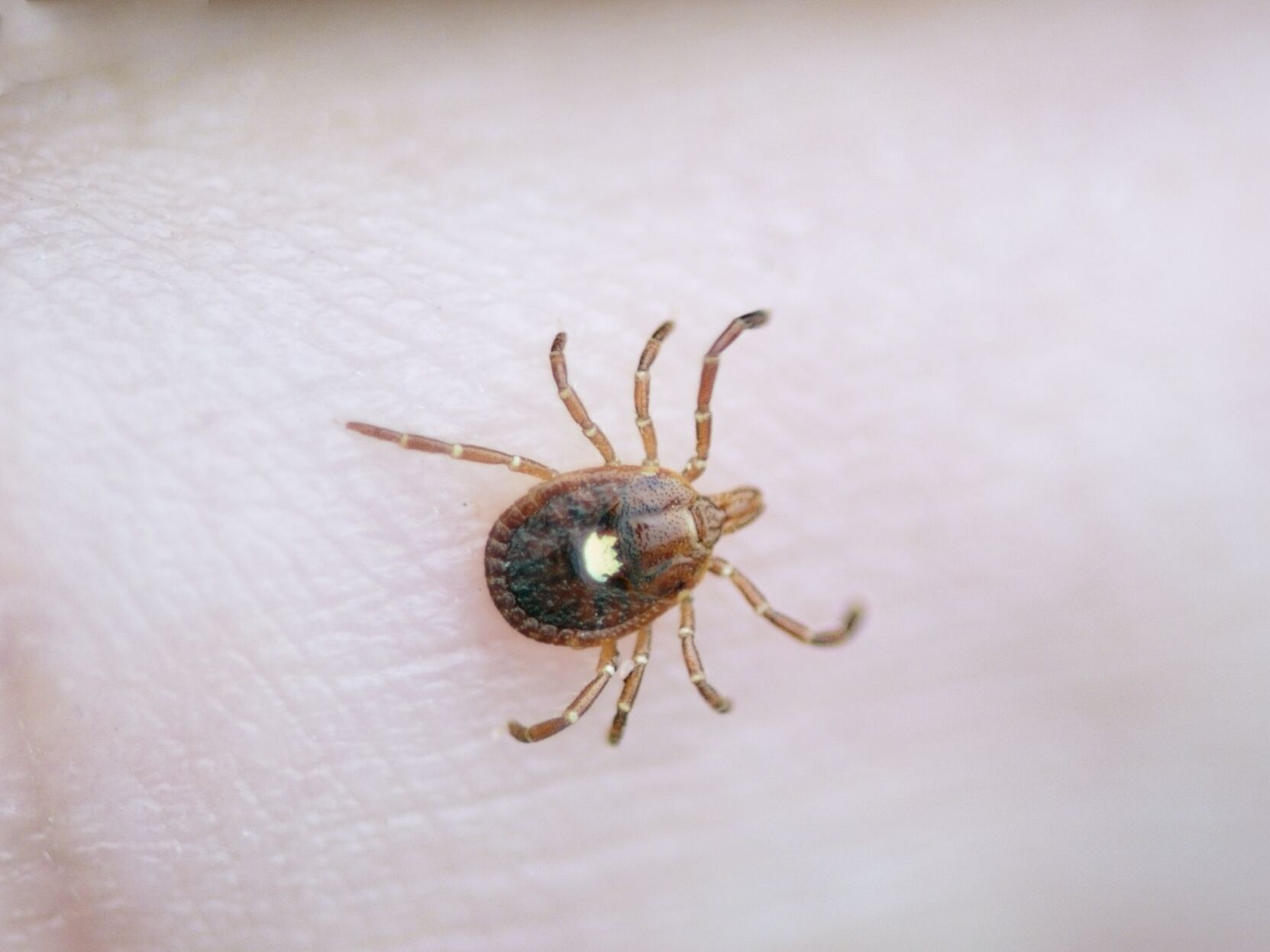 Protect yourself from ticks as ER visits ramp up | News ...