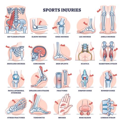 Common exercise injuries and how to avoid them | Health ...