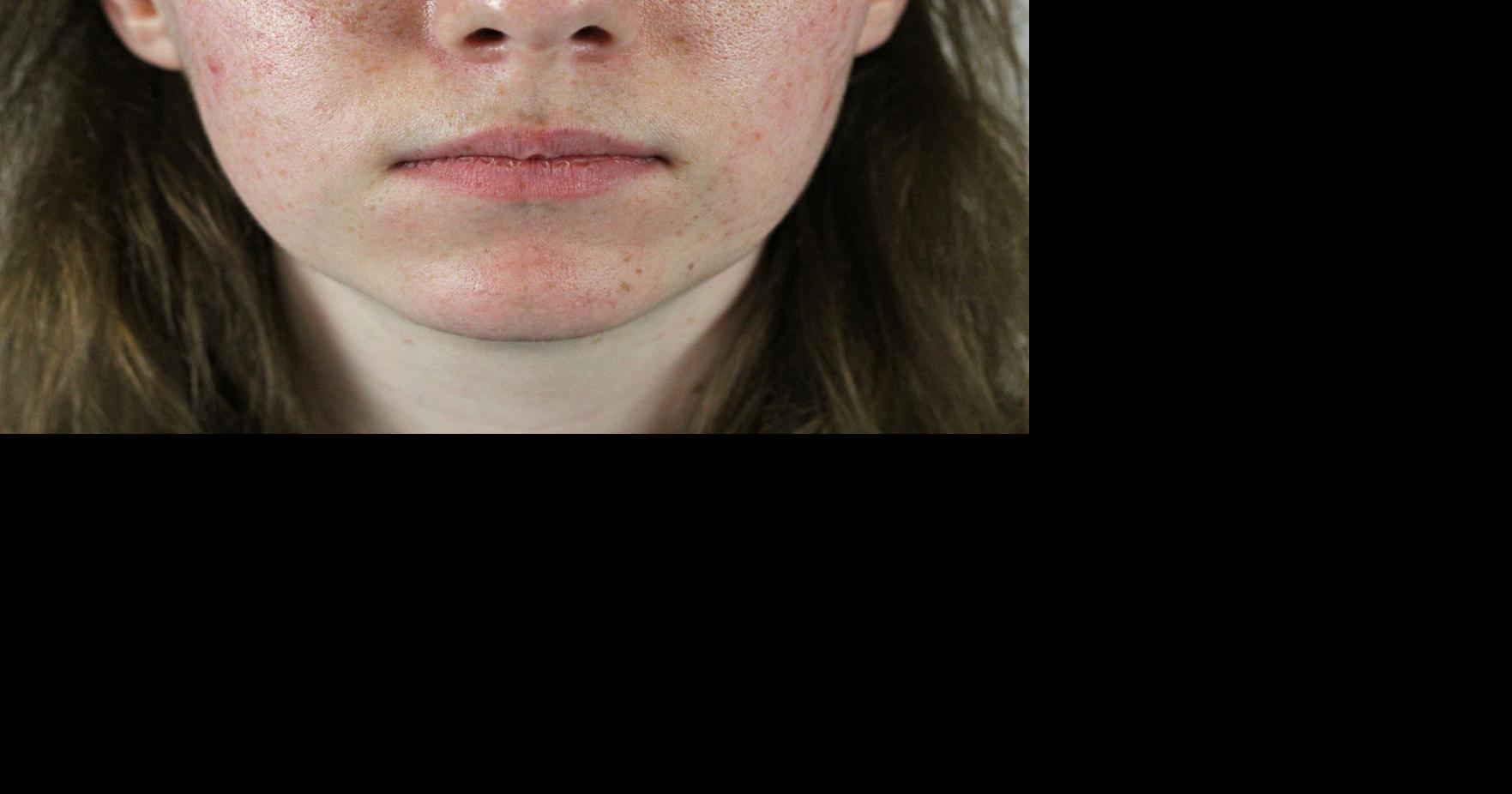Natural lip color indicates health status | Life + Entertainment ...