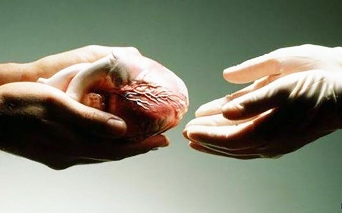 Organ donations continue to increase but still not meeting ...
