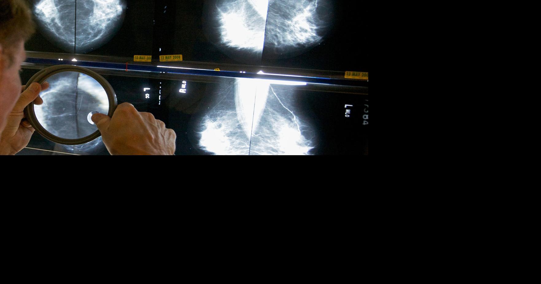 When should you get a mammogram?