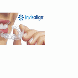 Invisalign — only you need to know…