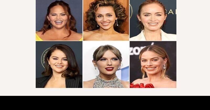 Selena Gomez veneers and our celebrity teeth obsession