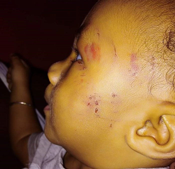 Baby beaten at daycare centre Local News