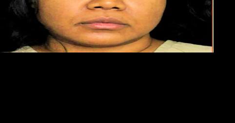 Trini smart woman jailed for US Covid fraud