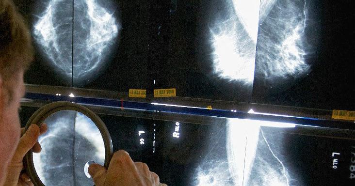 When to get a mammogram?