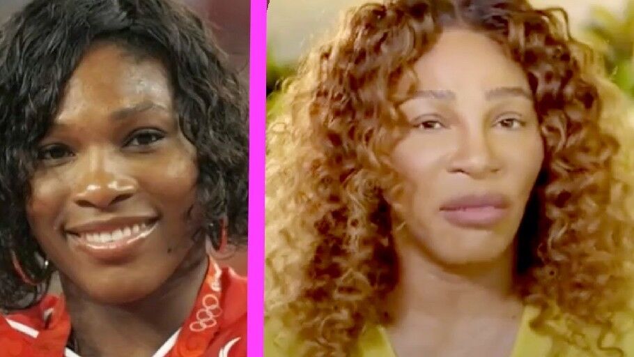 The Desire for Lighter Skin | Features