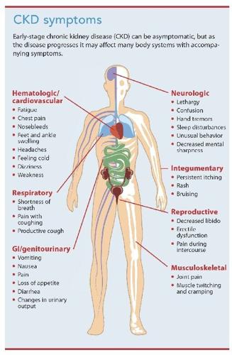 Chronic kidney disease | Features Local | trinidadexpress.com