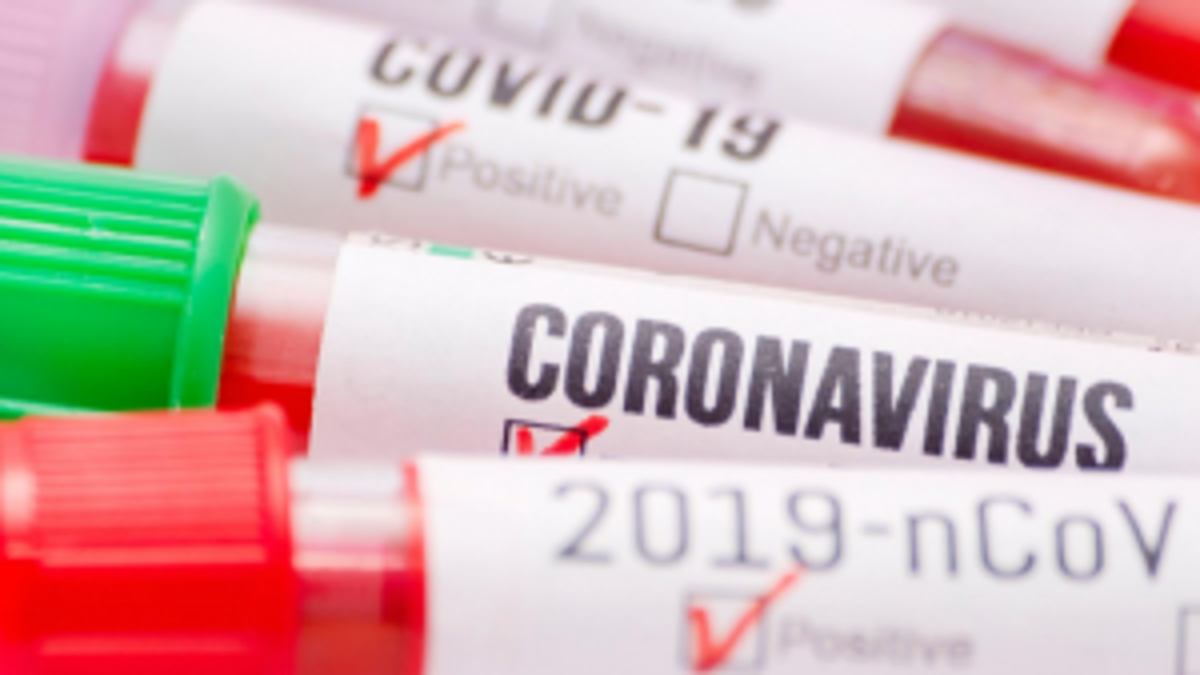 Oklahoma To Begin Counting Probable Cases In Confirmed Positive Covid 19 Data As Rapid Tests Increase Local News Tulsaworld Com
