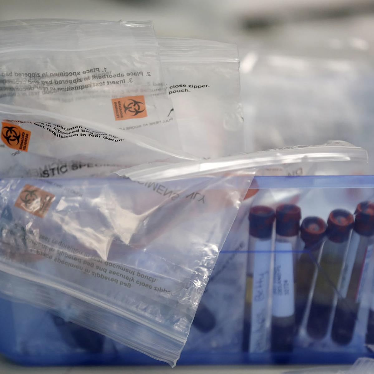 Covid 19 Five More Deaths Reported As Cases Rise By 148 Across