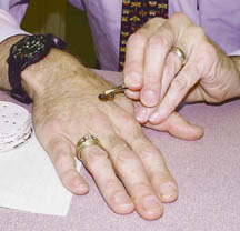 Apitherapist touts healing properties of bee sting